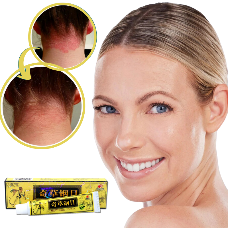 Derma Eterna™ Crème naturelle à base de plantes pour l'eczéma et le psoriasis