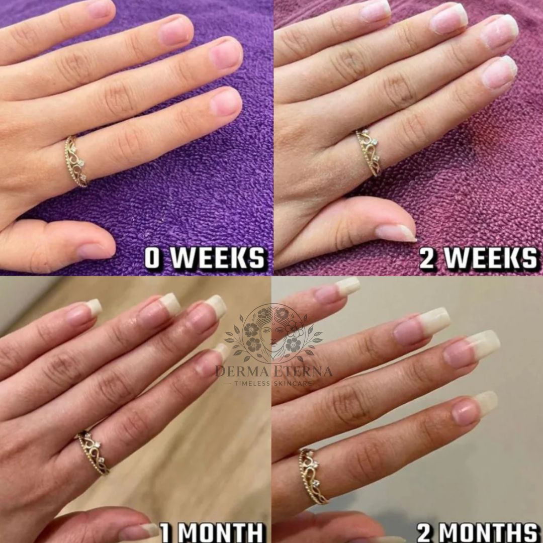 Stylo de croissance des ongles aux cellules souches – Revitalisant et huile fortifiante pour cuticules | Prévient la repousse des ongles, adoucit le vernis et nourrit les ongles