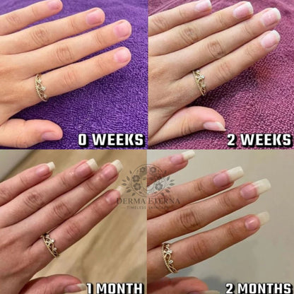 Stylo de croissance des ongles aux cellules souches – Revitalisant et huile fortifiante pour cuticules | Prévient la repousse des ongles, adoucit le vernis et nourrit les ongles