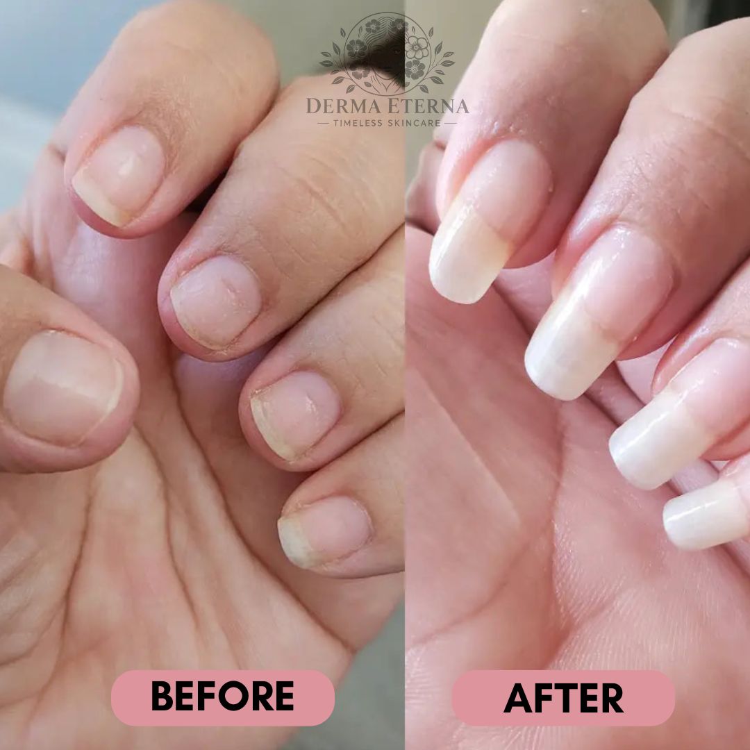 Stylo de croissance des ongles aux cellules souches – Revitalisant et huile fortifiante pour cuticules | Prévient la repousse des ongles, adoucit le vernis et nourrit les ongles