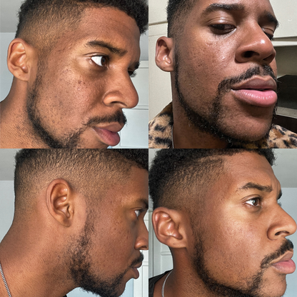 Sérum anti-taches brunes pour peaux normales, à l'acide kojique et aux antioxydants | Fabriqué aux États-Unis | Traitement sûr de l'hyperpigmentation et du mélasma